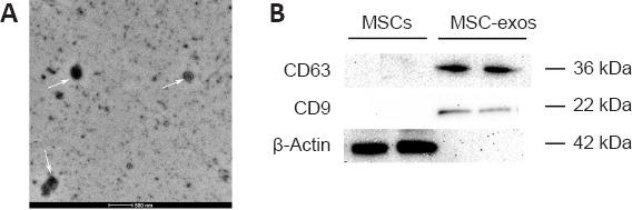 https://cdn.ncbi.nlm.nih.gov/pmc/blobs/0001/9838147/93574f70c259/NRR-18-1293-g003.jpg