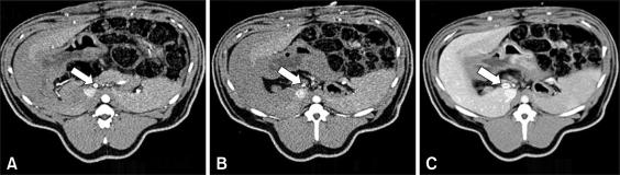 https://cdn.ncbi.nlm.nih.gov/pmc/blobs/0002/2801117/78cf2ace878c/jvs-10-93-g002.jpg