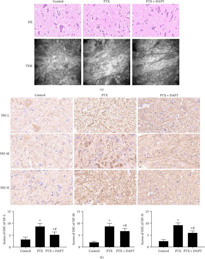 https://cdn.ncbi.nlm.nih.gov/pmc/blobs/0005/12031605/bfb847c50e1d/MI2025-4638804.002.jpg