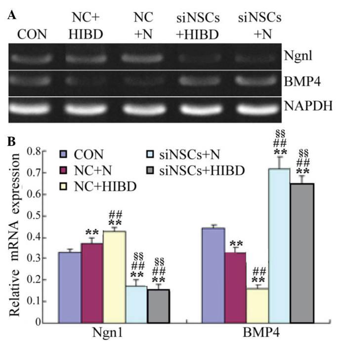 https://cdn.ncbi.nlm.nih.gov/pmc/blobs/001b/5042732/0436e1520c78/MMR-14-04-3595-g02.jpg