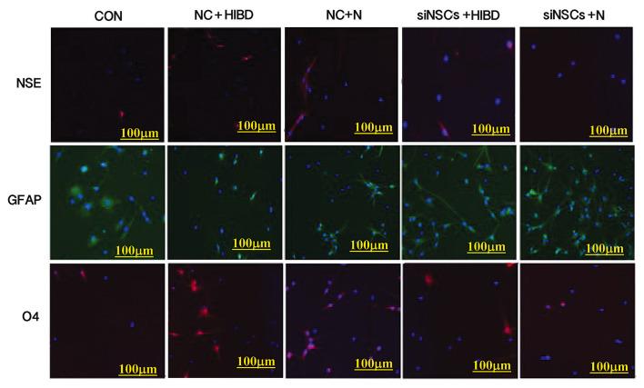 https://cdn.ncbi.nlm.nih.gov/pmc/blobs/001b/5042732/7c984d9bb129/MMR-14-04-3595-g00.jpg