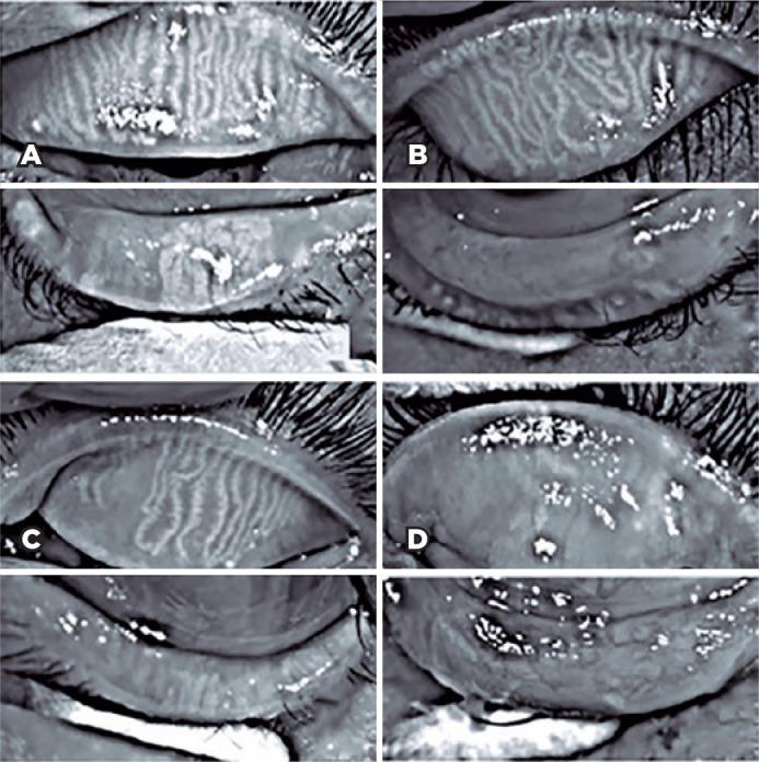 https://cdn.ncbi.nlm.nih.gov/pmc/blobs/001d/11620332/d96c49048833/abo-87-02-e2022-0319-g03.jpg