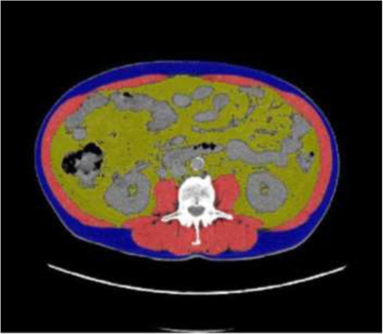 https://cdn.ncbi.nlm.nih.gov/pmc/blobs/001d/7245030/962bfe4471a7/13014_2020_1545_Fig1_HTML.jpg
