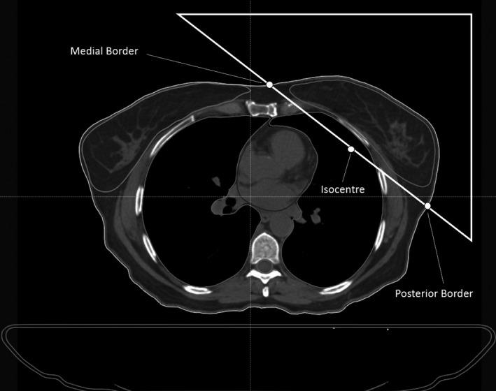 https://cdn.ncbi.nlm.nih.gov/pmc/blobs/0021/7700918/0e4f6ac086d3/ACM2-21-88-g001.jpg