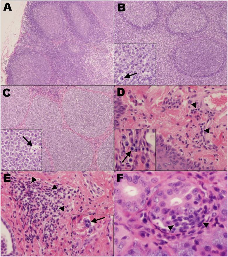 https://cdn.ncbi.nlm.nih.gov/pmc/blobs/0022/5608358/e70d5bba6ea7/pone.0185138.g003.jpg