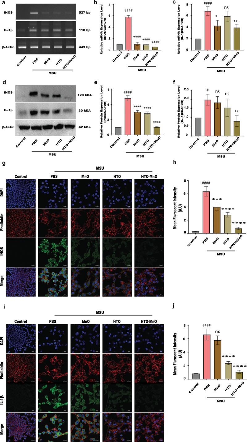 https://cdn.ncbi.nlm.nih.gov/pmc/blobs/0023/12164388/3fc6a2305b9b/TSTA_A_2491304_F0004_OC.jpg