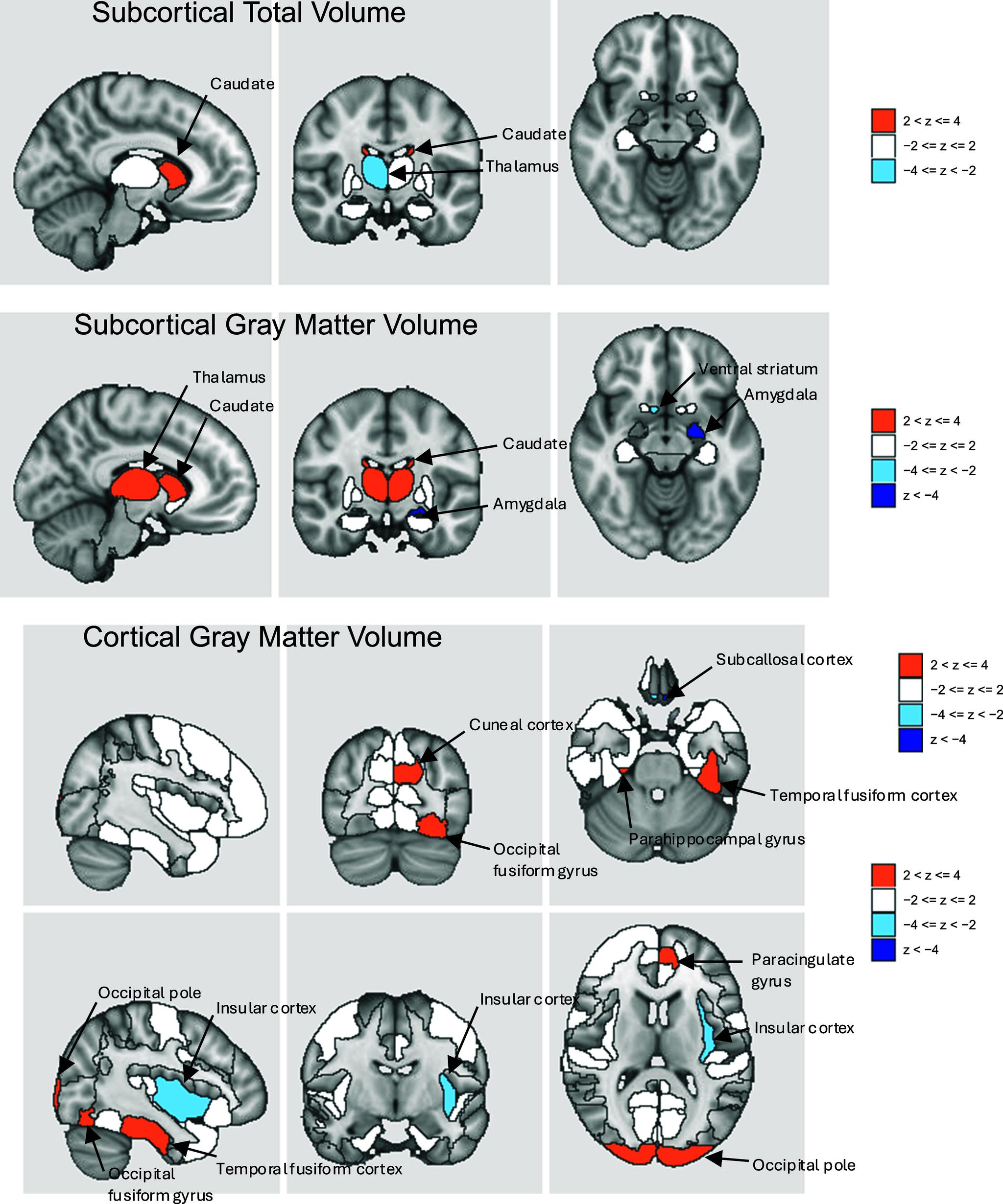 https://cdn.ncbi.nlm.nih.gov/pmc/blobs/0028/12094665/45128ffad0cc/S0033291725000819_fig3.jpg