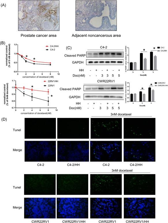 https://cdn.ncbi.nlm.nih.gov/pmc/blobs/0029/6594129/3a89d869ae06/PROS-79-1018-g001.jpg