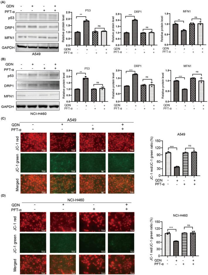 https://cdn.ncbi.nlm.nih.gov/pmc/blobs/002a/11057058/fcaec22abcd2/JCMM-28-e18353-g007.jpg