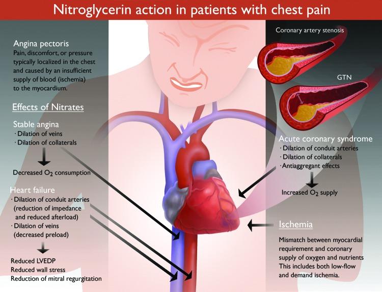 https://cdn.ncbi.nlm.nih.gov/pmc/blobs/002c/4752190/3287212d82e3/fig-1.jpg