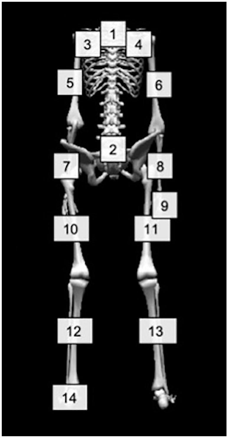 https://cdn.ncbi.nlm.nih.gov/pmc/blobs/002d/8739590/29c43328f1b6/10.1177_03635465211055141-fig2.jpg