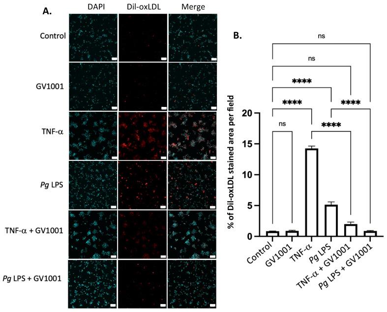 https://cdn.ncbi.nlm.nih.gov/pmc/blobs/0035/11172542/3c0ef2af6397/ijms-25-06126-g010.jpg