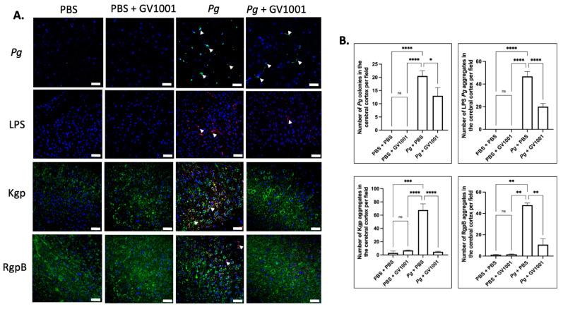 https://cdn.ncbi.nlm.nih.gov/pmc/blobs/0035/11172542/814617b91a38/ijms-25-06126-g013.jpg