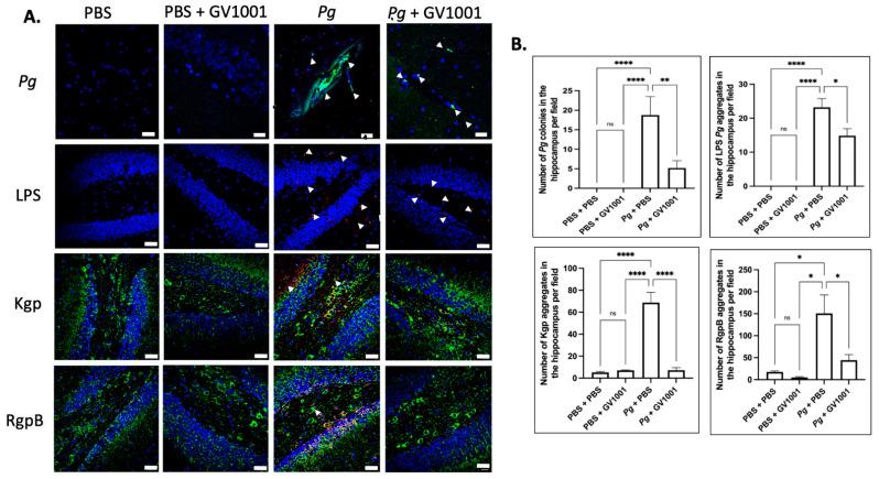 https://cdn.ncbi.nlm.nih.gov/pmc/blobs/0035/11172542/934b95d33c59/ijms-25-06126-g014.jpg
