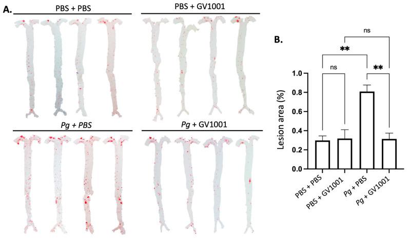 https://cdn.ncbi.nlm.nih.gov/pmc/blobs/0035/11172542/d027a39dff78/ijms-25-06126-g008.jpg