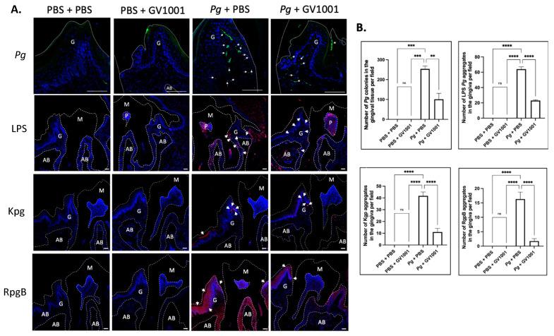 https://cdn.ncbi.nlm.nih.gov/pmc/blobs/0035/11172542/e5d81193b4a2/ijms-25-06126-g003.jpg