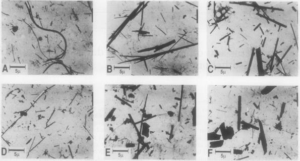 https://cdn.ncbi.nlm.nih.gov/pmc/blobs/0038/462680/77504de60c06/thorax00345-0002-a.jpg