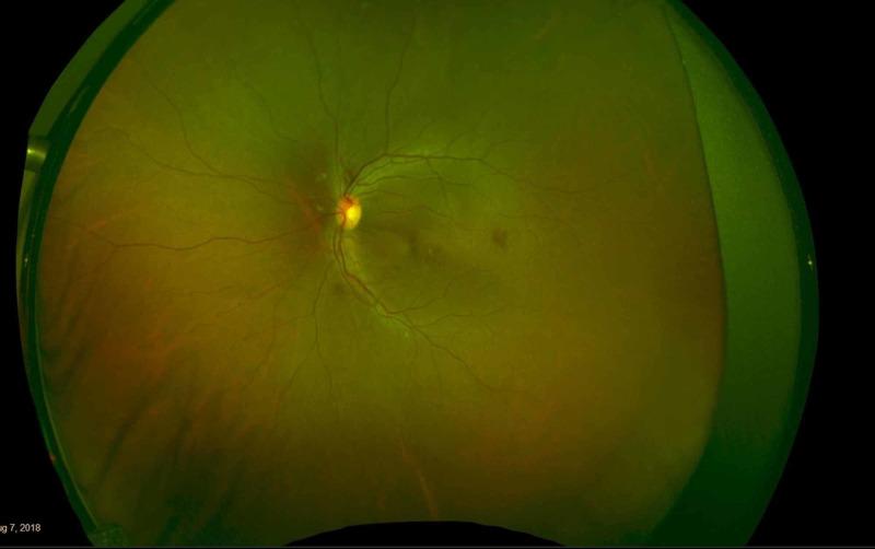 https://cdn.ncbi.nlm.nih.gov/pmc/blobs/0039/7975131/54c0823820fa/cureus-0013-00000013387-i02.jpg