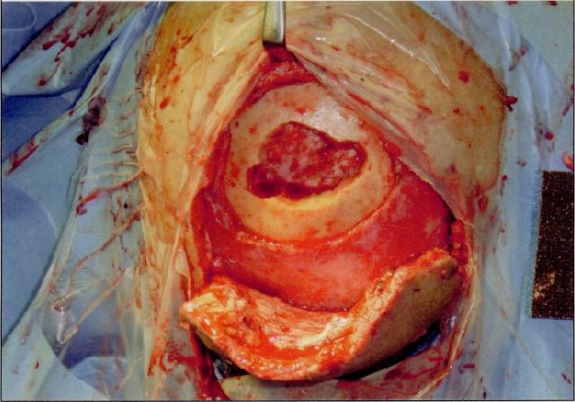 https://cdn.ncbi.nlm.nih.gov/pmc/blobs/003c/2568600/584f2889daa7/jnma00180-0119-a.jpg