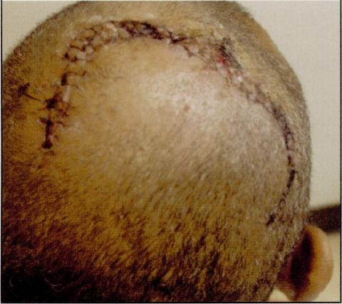 https://cdn.ncbi.nlm.nih.gov/pmc/blobs/003c/2568600/f375a533fdfa/jnma00180-0116-a.jpg