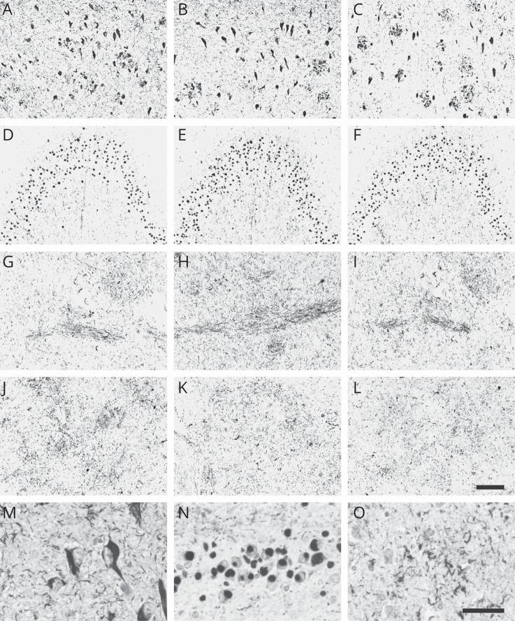 https://cdn.ncbi.nlm.nih.gov/pmc/blobs/0047/7734919/e83c4092e300/NEUROLOGY2020070052FF2.jpg