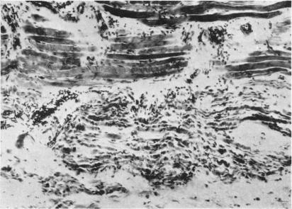 https://cdn.ncbi.nlm.nih.gov/pmc/blobs/004e/2012904/0863d7dec34d/archdisch01597-0092-b.jpg