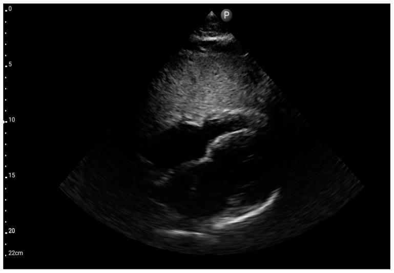 https://cdn.ncbi.nlm.nih.gov/pmc/blobs/0054/10971135/d307cb10444a/jcm-13-01573-g007.jpg