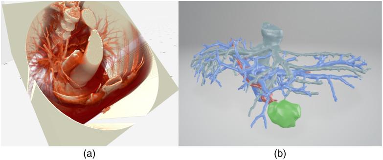 https://cdn.ncbi.nlm.nih.gov/pmc/blobs/005c/11043584/d6a8379d09a1/JMI-011-062603-g007.jpg