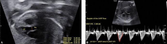 https://cdn.ncbi.nlm.nih.gov/pmc/blobs/005f/6988455/d43896a8a26b/jou-19-79-287-g004.jpg