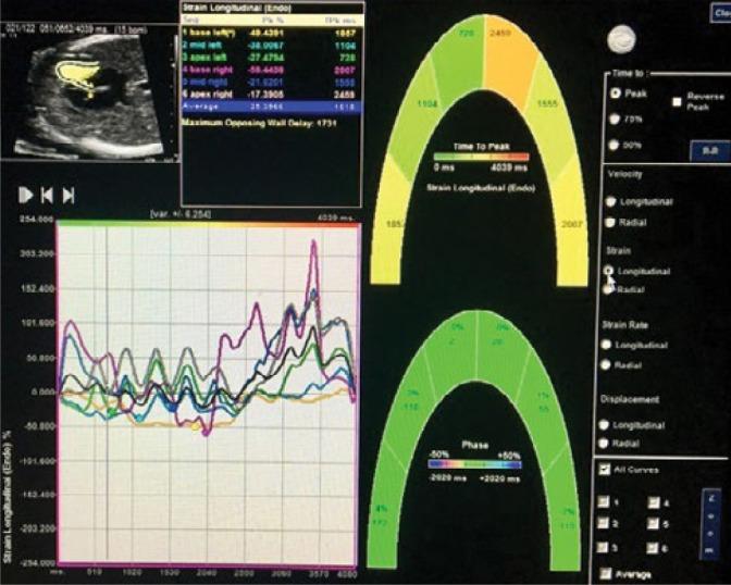 https://cdn.ncbi.nlm.nih.gov/pmc/blobs/005f/6988455/f8d85ad0620c/jou-19-79-287-g003.jpg