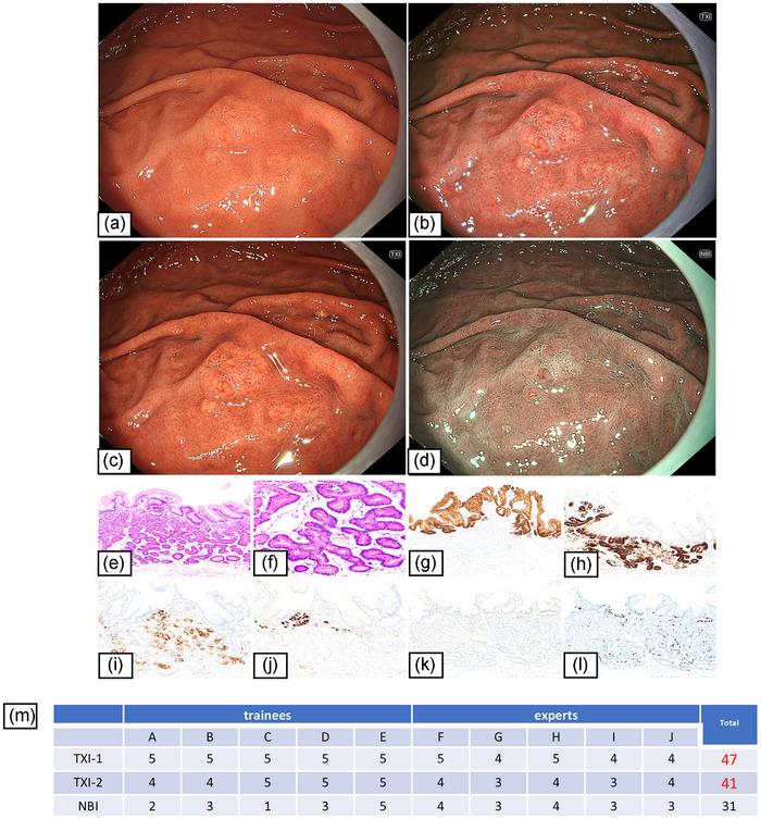 https://cdn.ncbi.nlm.nih.gov/pmc/blobs/0061/11977659/be21ba535f38/DEO2-5-e70110-g003.jpg