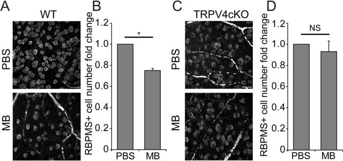 https://cdn.ncbi.nlm.nih.gov/pmc/blobs/0065/11261973/2ee8ec4fc2d4/nihpp-rs4714050v1-f0006.jpg