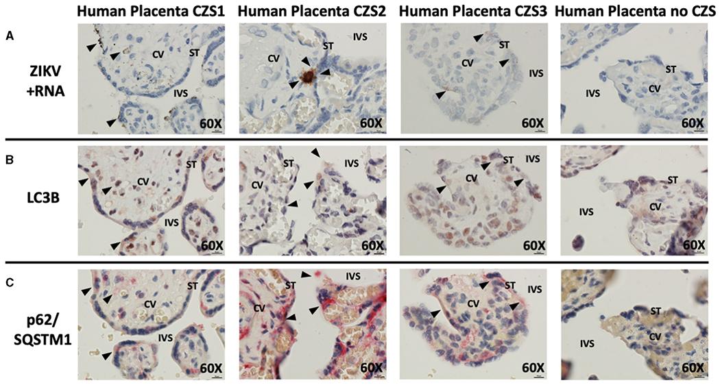 https://cdn.ncbi.nlm.nih.gov/pmc/blobs/006a/10331925/c69a642c2b3a/nihms-1913394-f0002.jpg