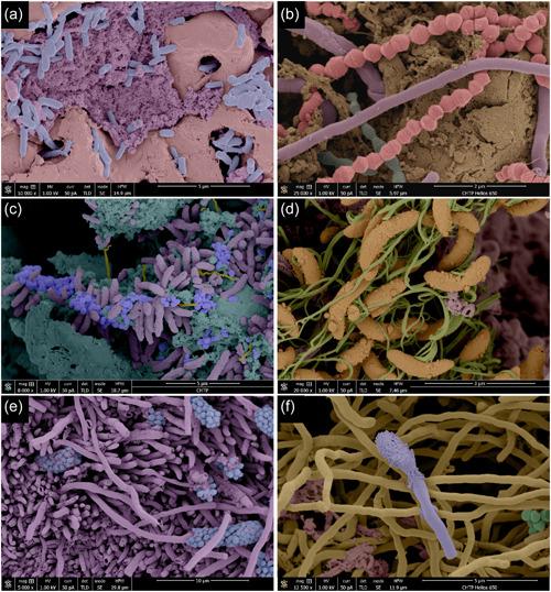 https://cdn.ncbi.nlm.nih.gov/pmc/blobs/006e/10441592/ce9b9f3f3f7d/CRE2-9-586-g003.jpg