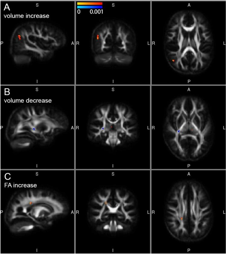 https://cdn.ncbi.nlm.nih.gov/pmc/blobs/006f/12092486/1e949bf1ca0d/429_2025_2937_Fig4_HTML.jpg