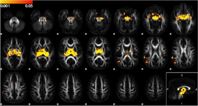 https://cdn.ncbi.nlm.nih.gov/pmc/blobs/006f/12092486/8af4ead4b23f/429_2025_2937_Fig1_HTML.jpg