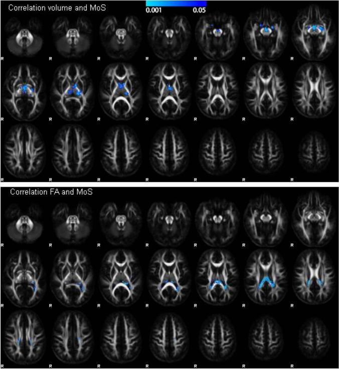 https://cdn.ncbi.nlm.nih.gov/pmc/blobs/006f/12092486/c28b503c61a5/429_2025_2937_Fig3_HTML.jpg