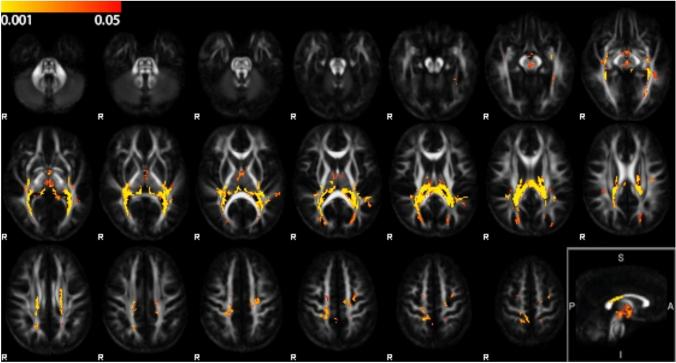 https://cdn.ncbi.nlm.nih.gov/pmc/blobs/006f/12092486/cd5dca2af818/429_2025_2937_Fig2_HTML.jpg