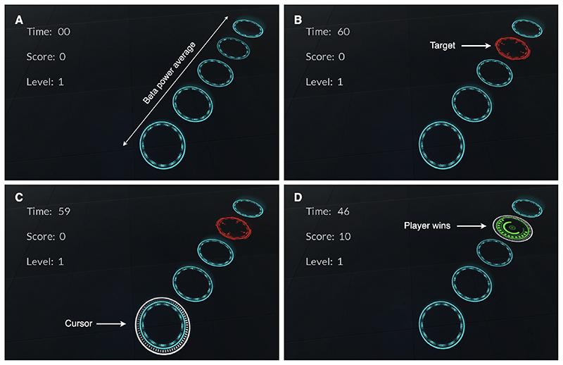 https://cdn.ncbi.nlm.nih.gov/pmc/blobs/006f/7116886/ce993637234a/EMS117411-f002.jpg