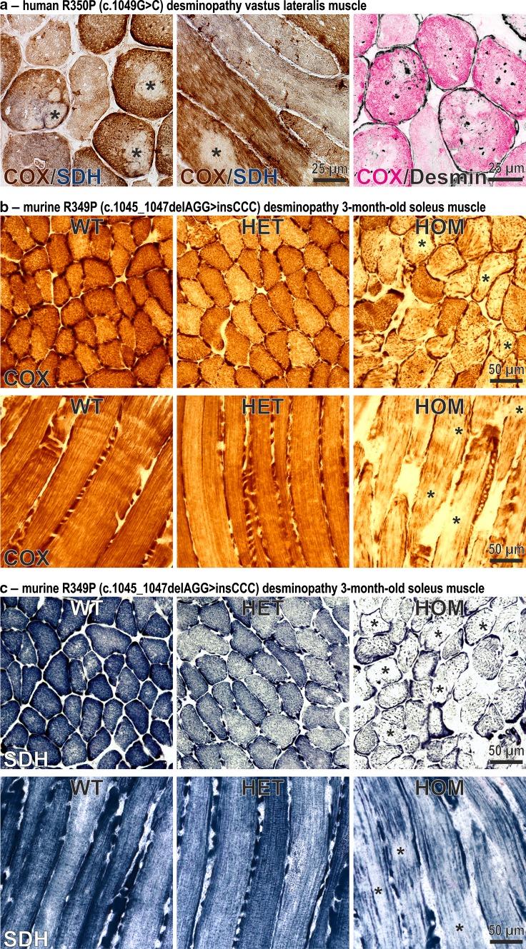 https://cdn.ncbi.nlm.nih.gov/pmc/blobs/0079/4992032/4172ce2a4455/401_2016_1592_Fig1_HTML.jpg
