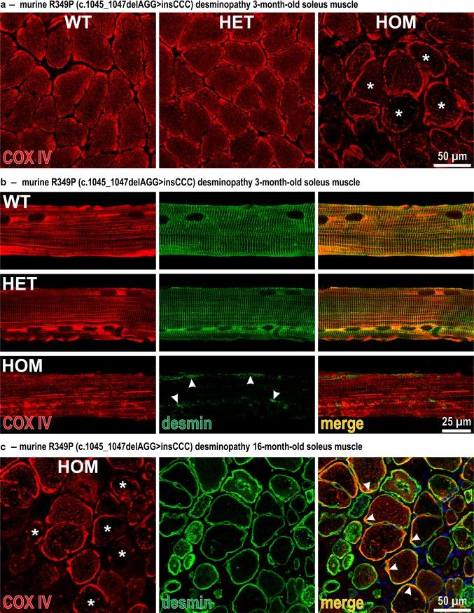 https://cdn.ncbi.nlm.nih.gov/pmc/blobs/0079/4992032/fe562120dd2e/401_2016_1592_Fig2_HTML.jpg