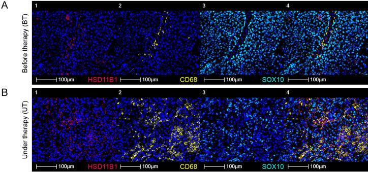https://cdn.ncbi.nlm.nih.gov/pmc/blobs/007a/10083881/c4b6da11b7c8/jitc-2021-004150f02.jpg