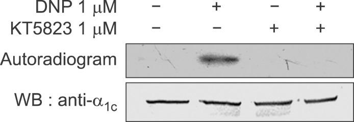 https://cdn.ncbi.nlm.nih.gov/pmc/blobs/007a/3389074/539253da8040/emm-44-363-g005.jpg