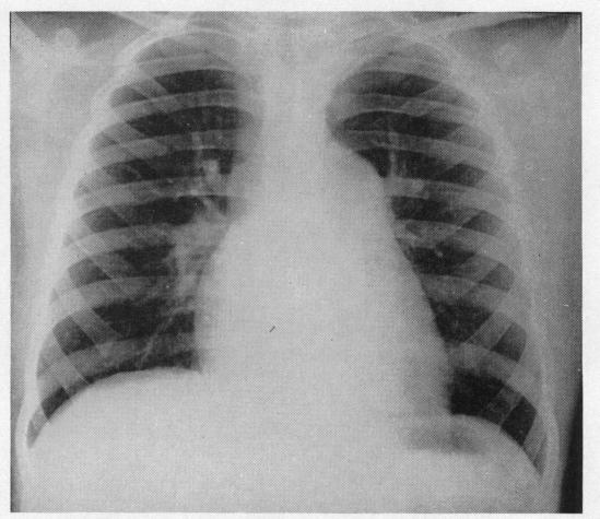 https://cdn.ncbi.nlm.nih.gov/pmc/blobs/007d/1017798/923a52749236/brheartj00365-0004-a.jpg