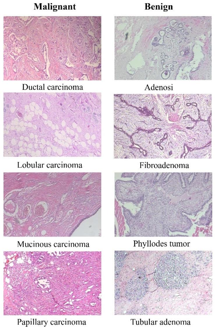 https://cdn.ncbi.nlm.nih.gov/pmc/blobs/007e/11201924/3ec611860ba5/cancers-16-02222-g002.jpg