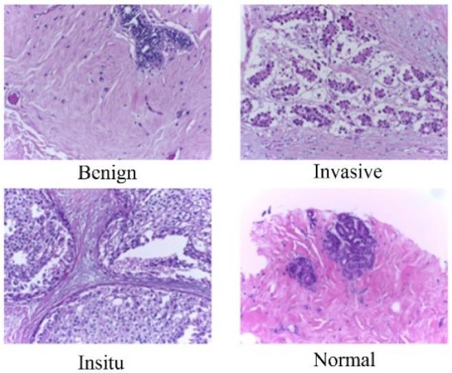https://cdn.ncbi.nlm.nih.gov/pmc/blobs/007e/11201924/76d35c6a6411/cancers-16-02222-g001.jpg