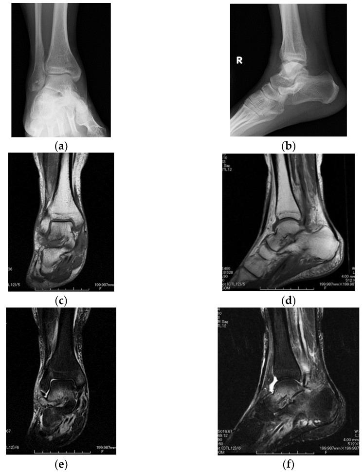 https://cdn.ncbi.nlm.nih.gov/pmc/blobs/007e/9600197/485648ee59a0/diagnostics-12-02311-g001.jpg