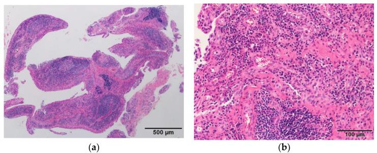 https://cdn.ncbi.nlm.nih.gov/pmc/blobs/007e/9600197/b1505c181fe2/diagnostics-12-02311-g004.jpg