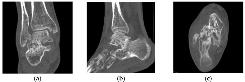 https://cdn.ncbi.nlm.nih.gov/pmc/blobs/007e/9600197/ddc2eda16200/diagnostics-12-02311-g003.jpg