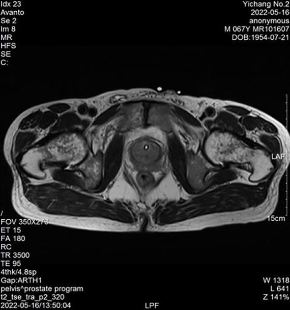 https://cdn.ncbi.nlm.nih.gov/pmc/blobs/007f/11955490/8836fe1b56b1/fonc-15-1553415-g001.jpg